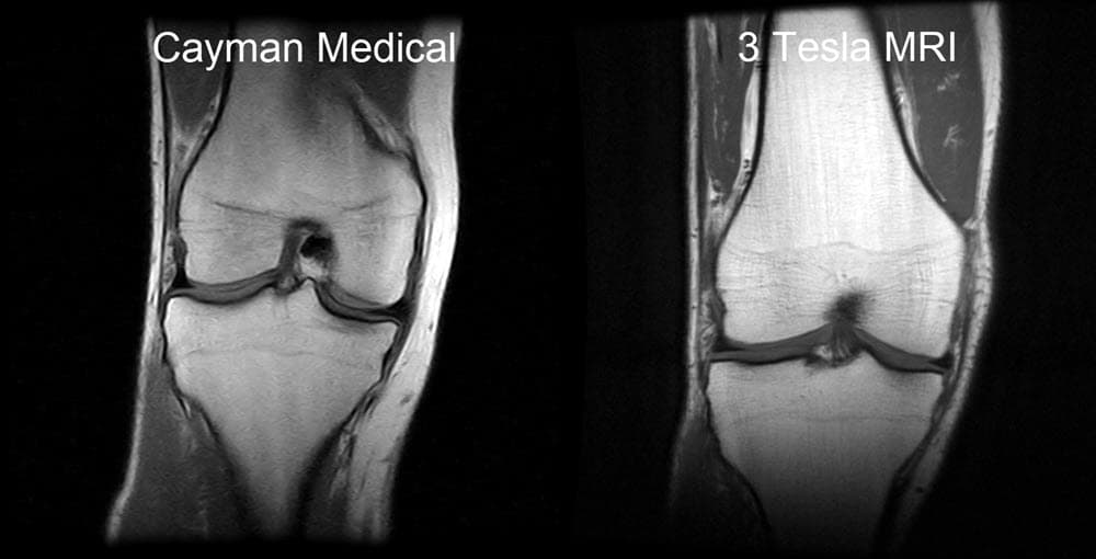 Original Cayman Medical MRI comparison 1