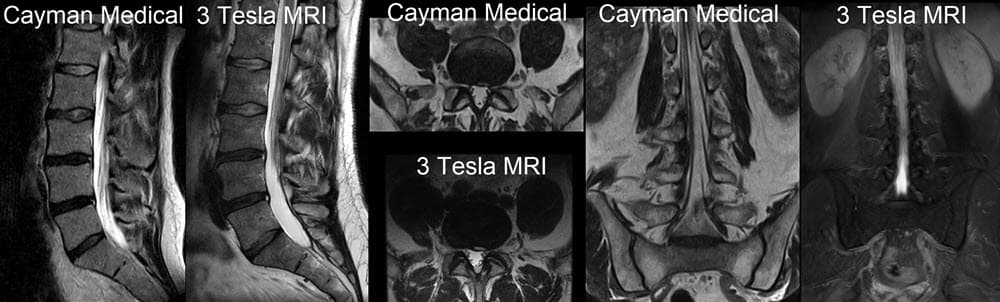 Original Cayman Medical MRI comparison 10
