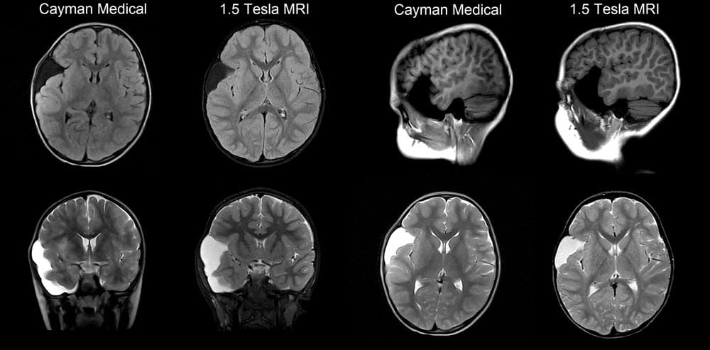 Original Cayman Medical MRI comparison 11