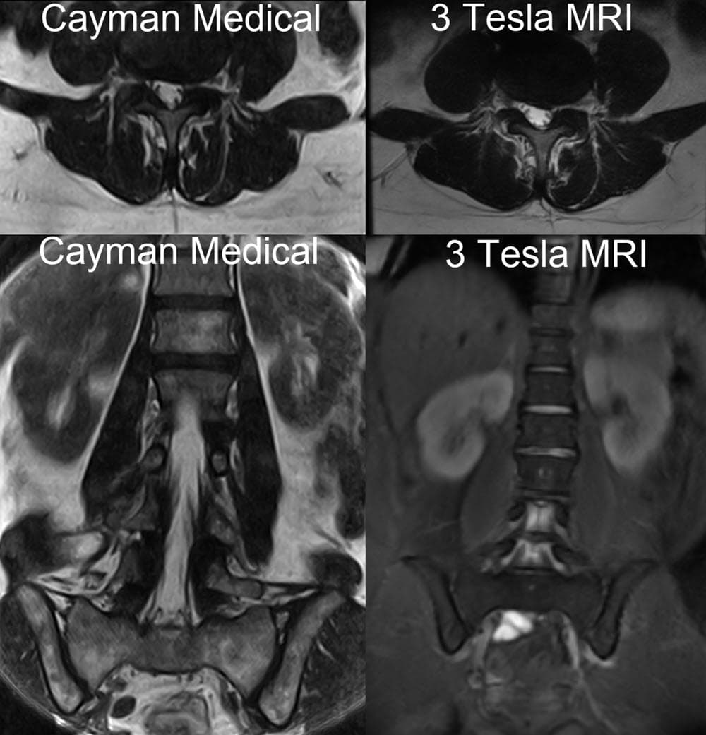 Original Cayman Medical MRI comparison 12