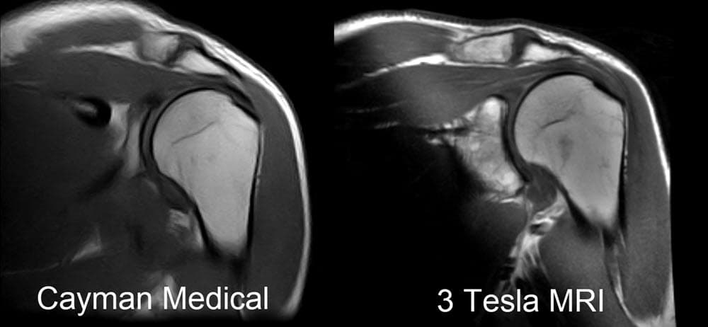 Original Cayman Medical MRI comparison 2