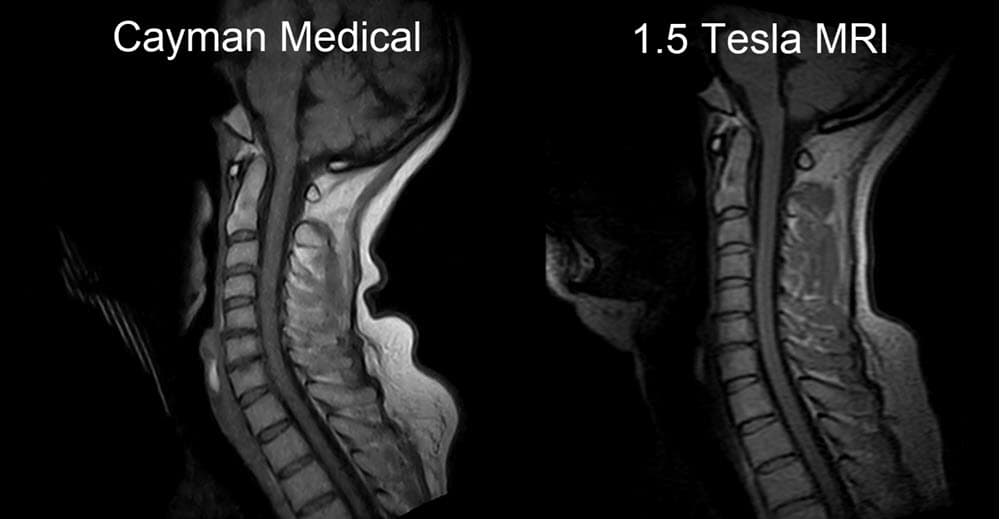 Original Cayman Medical MRI comparison 3