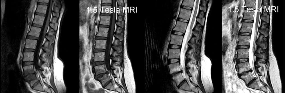 Original Cayman Medical MRI comparison 4