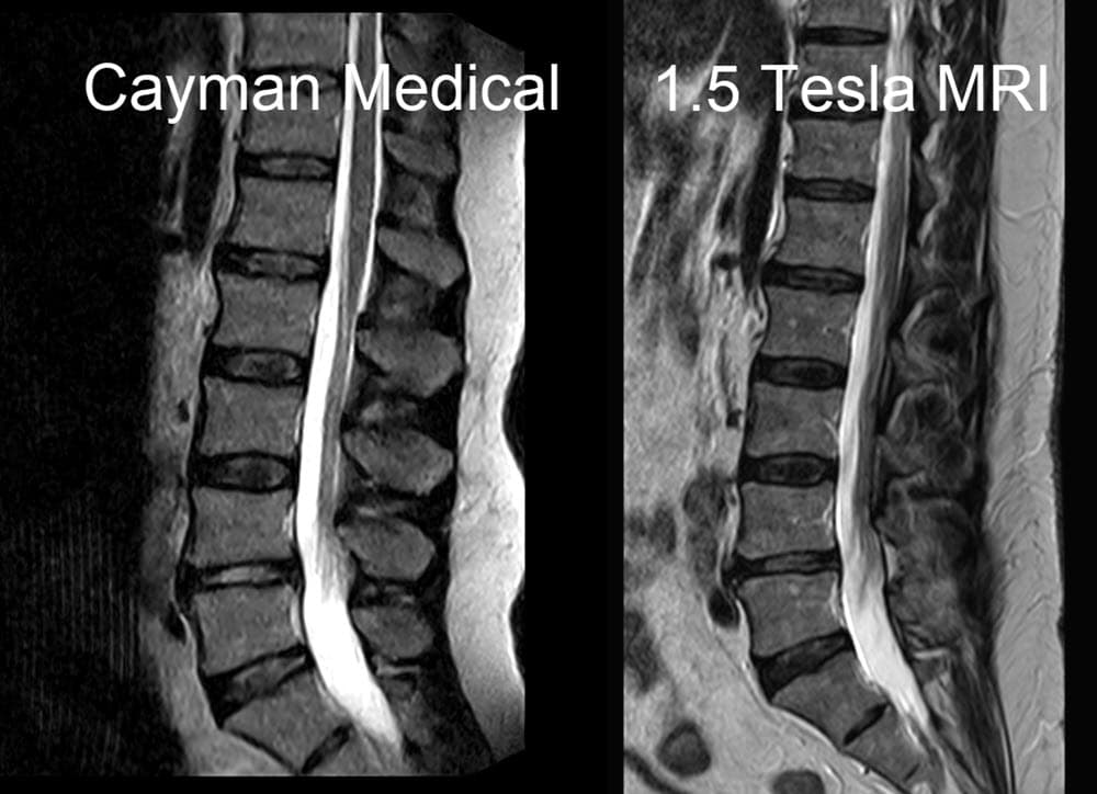 Original Cayman Medical MRI comparison 5