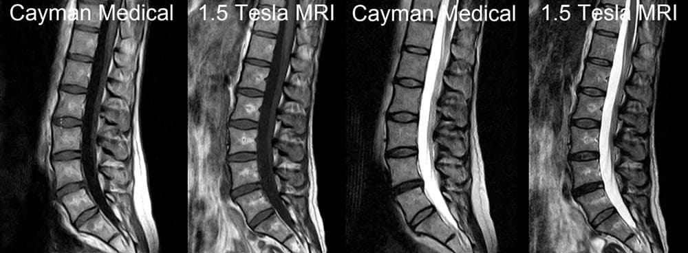 Original Cayman Medical MRI comparison 6