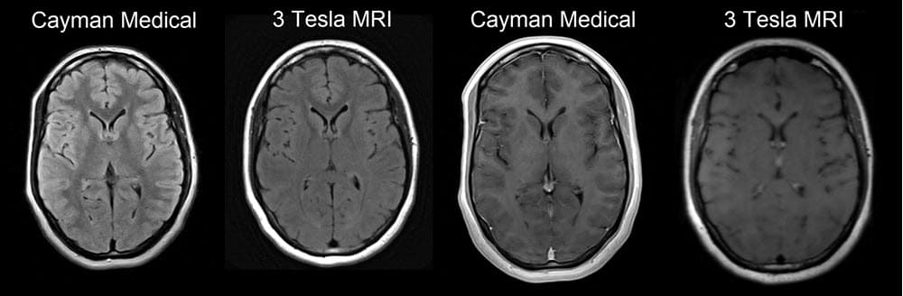 Original Cayman Medical MRI comparison 7