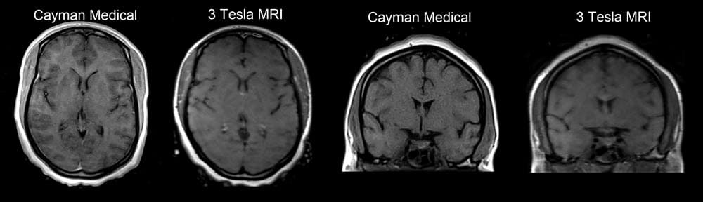 Original Cayman Medical MRI comparison 8