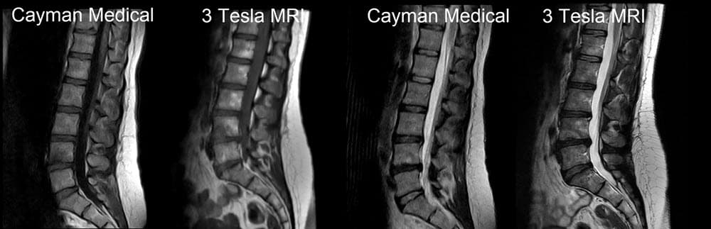 Original Cayman Medical MRI comparison 9