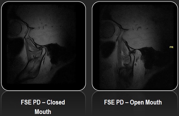 Temporomandibular joints - dynamic images